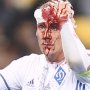 VIDEO: Hororové zranenie v Európskej lige. Z hlavy kapitána Kyjeva sa doslova liala krv